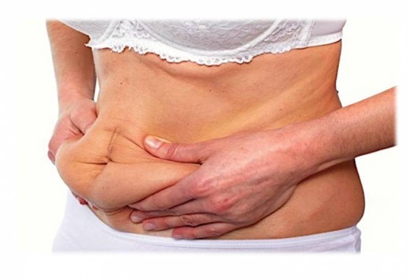 Abdominoplastia Barriga Inchada Preço Morumbi - Abdominoplastia com Lipoescultura