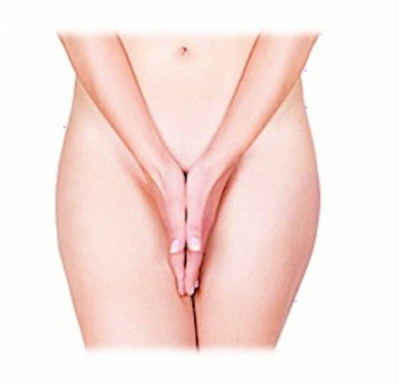 Cirurgia Redução Lábios Vaginais Valor Perdizes - Labioplastia Feminina