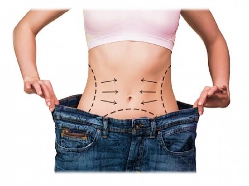 Clínica de Abdominoplastia Pós-cirurgia Bariátrica Vila Morumbi - Abdominoplastia em âncora