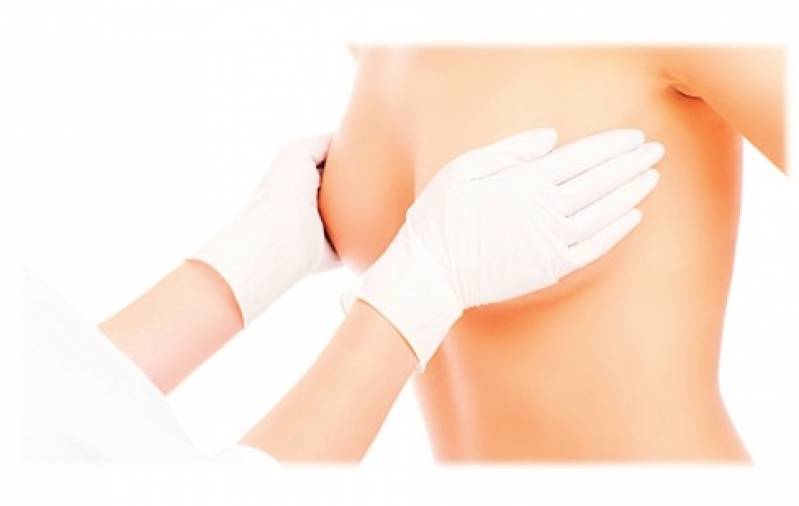 Mamoplastia Redutora de Mama Preço Jardim Europa - Mamoplastia Redutora Levantamento