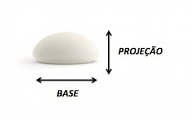 Prótese de Silicone e Mamoplastia Valor Cidade Jardim - Prótese de Silicone e Mamoplastia