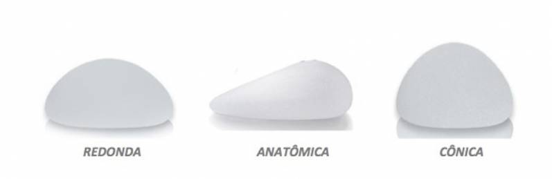 Prótese de Silicone Preço Jardim Paulista - Prótese de Silicone e Mamoplastia