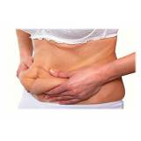 abdominoplastia barriga inchada