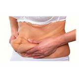 Abdominoplastia Barriga Inchada