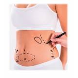 Abdominoplastia com Lipoescultura