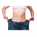 abdominoplastia pós-cirurgia bariátrica