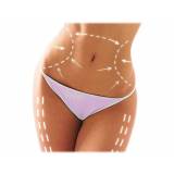 abdominoplastia pós-cirurgia bariátrica preço Pompéia