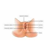 cirurgia para lábios vaginais Santana