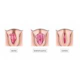 cirurgia plástica íntima feminina Brooklin