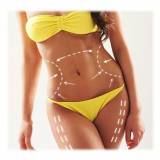 cirurgia plástica para afinar a cintura valor São Caetano do Sul