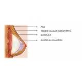 cirurgia prótese mamas preço Pompéia