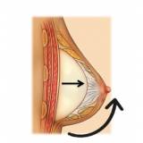 cirurgia prótese mamas valor Jardim Europa