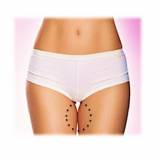 lipoaspiração coxas Brooklin