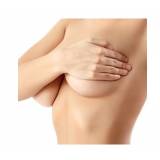 mamoplastia redutora com próteses valor Perdizes
