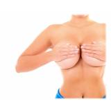 mamoplastia redutora e levantamento de mama valor Saúde