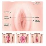 onde encontro cirurgia intima de labioplastia Ipiranga