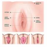 onde encontro cirurgia intima de labioplastia Itaim Bibi