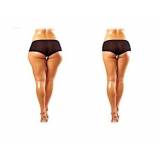 onde encontro lipoaspiração para culote Jardim Europa